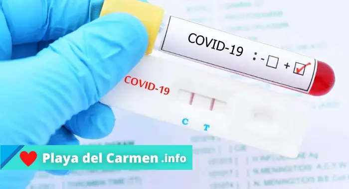 Precio prueba COVID en Cruz Roja Playa del Carmen ¿Cuanto cuesta?